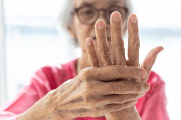 Rheumatoid Arthritis | Rheumatoid Arthritis Treatment | ARC Hyd